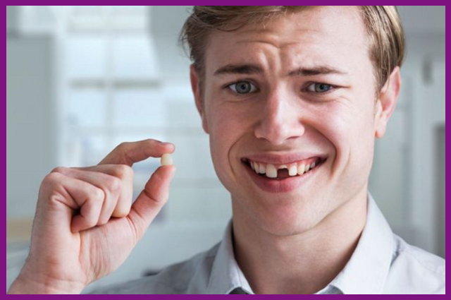 xem xét kỹ tình trạng mất răng để chọn loại phục hình răng phù hợp