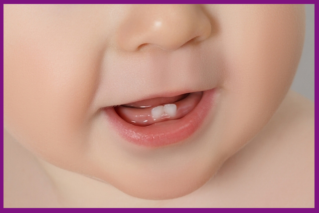 Quá trình mọc răng và thay răng trẻ em