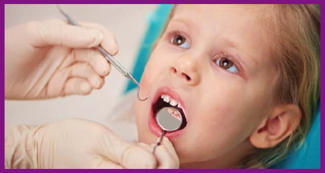 khám răng định kỳ với bác sĩ sẽ giúp bảo vệ sức khỏe răng miệng cho bé