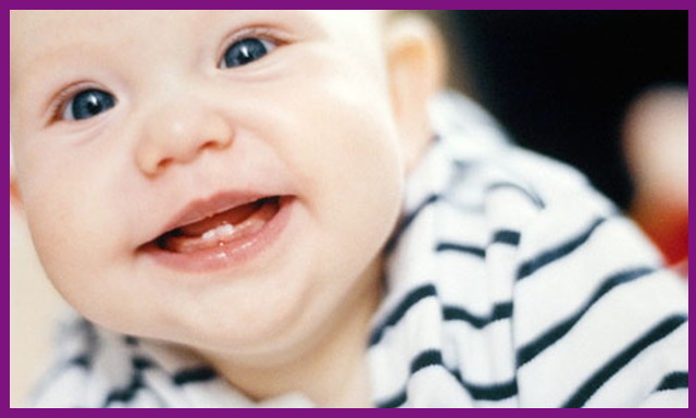 bé 17 tháng mà chỉ mọc được 6 cái răng được xem là tình trạng chậm mọc răng