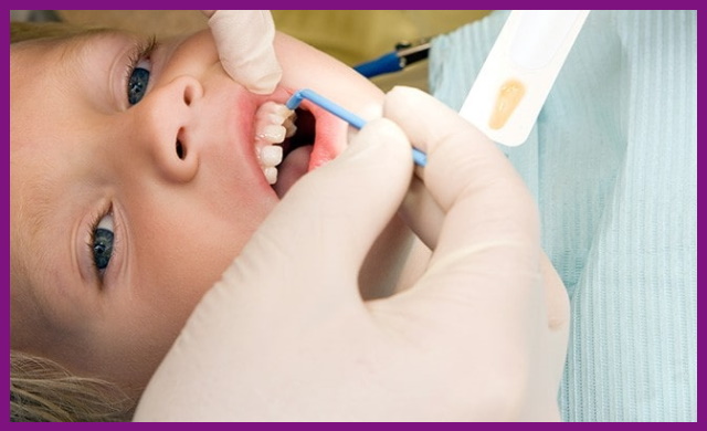 sâu răng nặng không nên nhổ tại nhà mà phải đến nha khoa để gặp bác sĩ