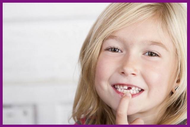 trẻ em là lứa tuổi rất dễ mắc các bệnh về răng miệng nhất