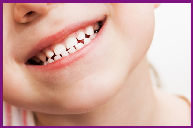 thông qua việc thăm khám răng định kỳ sẽ giúp bé có được một hàm răng chắc khỏe hơn