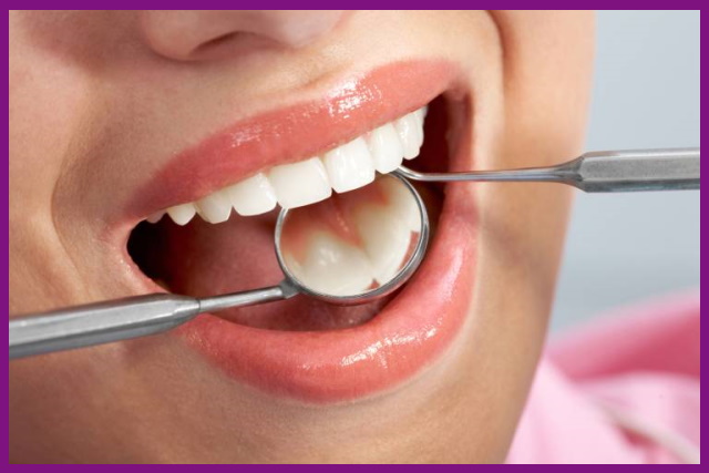 nên thăm khám răng định kỳ để phát hiện sớm các dấu hiệu của bệnh nha chu