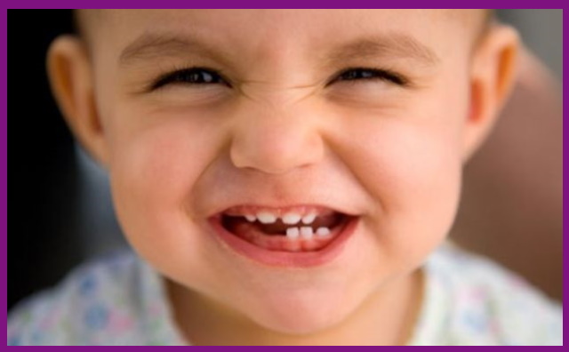 khám răng định kỳ sẽ giúp răng bé mọc lên đều và đẹp hơn