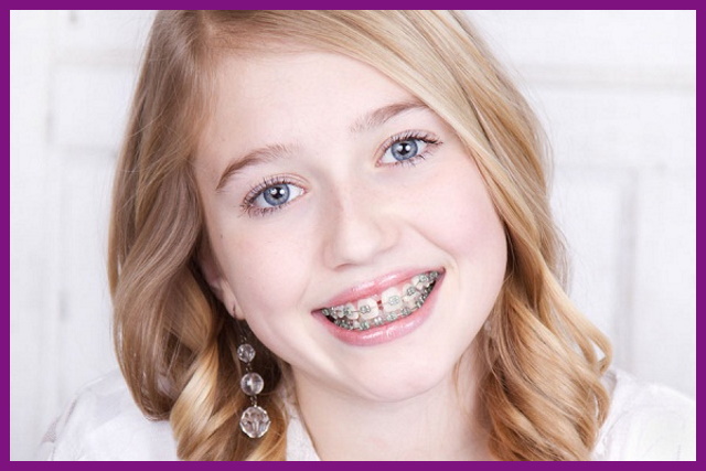 nếu trẻ đang gặp các bệnh lý về răng miệng thì cần điều trị trước khi niềng răng