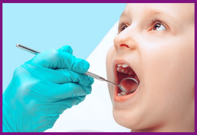 khám răng định kỳ là cần thiếu trong việc chăm sóc răng miệng cho bé