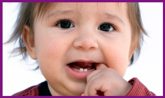 tụ máu dưới răng cũng là biểu hiện cho thấy bé đang mọc răng
