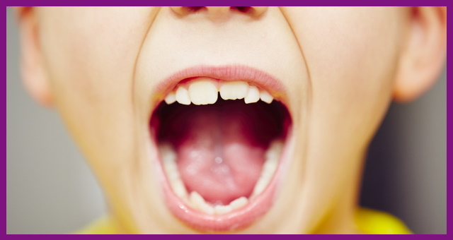 khám răng sẽ giúp bác sĩ điều chỉnh kịp thời tình trạng răng mọc lệch lạc ở trẻ
