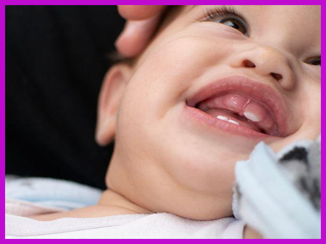 hiện tượng mọc răng ở trẻ sơ sinh là sao