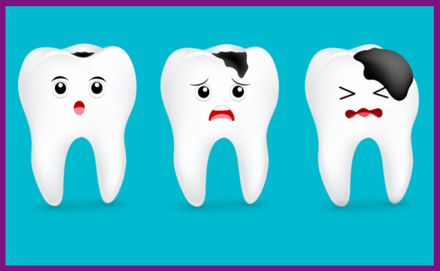 khám răng định kỳ sẽ giúp ngăn ngừa được tình trạng sâu răng rất hay xảy ra ở trẻ nhỏ