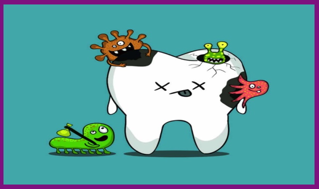 sâu răng là bệnh lý răng miệng rất phổ biến ở trẻ nhỏ do việc tiêu thụ quá nhiều đồ ngọt