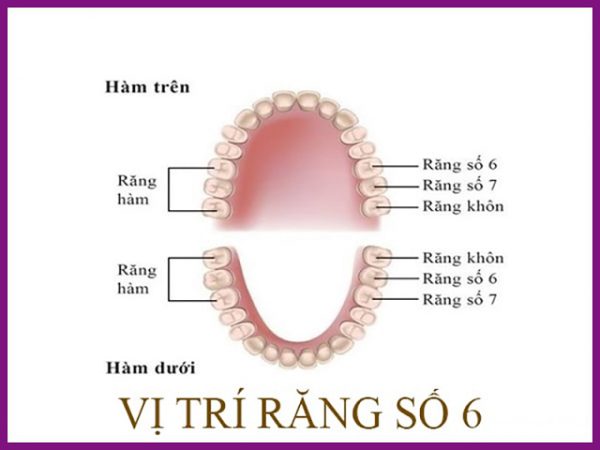 Nhổ răng số 6 có nguy hiểm không