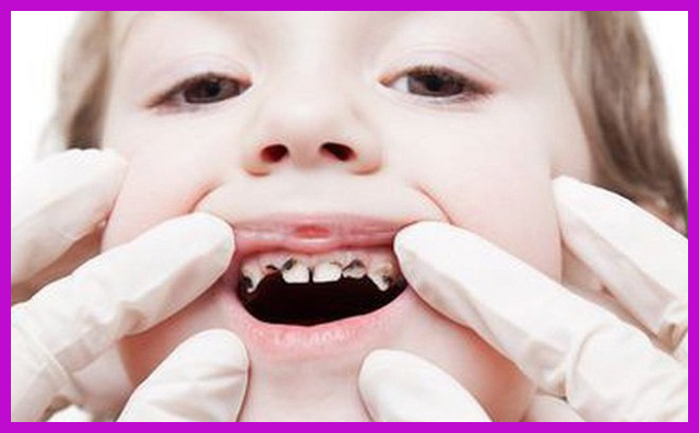 quy trình mọc răng của bé có khó không