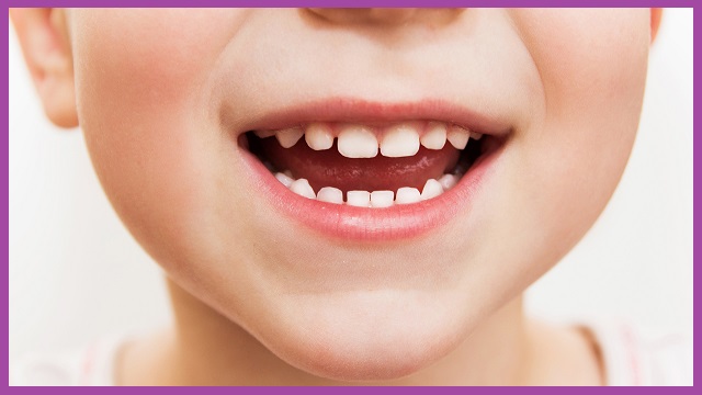 răng sữa ảnh hưởng đến răng vĩnh viễn