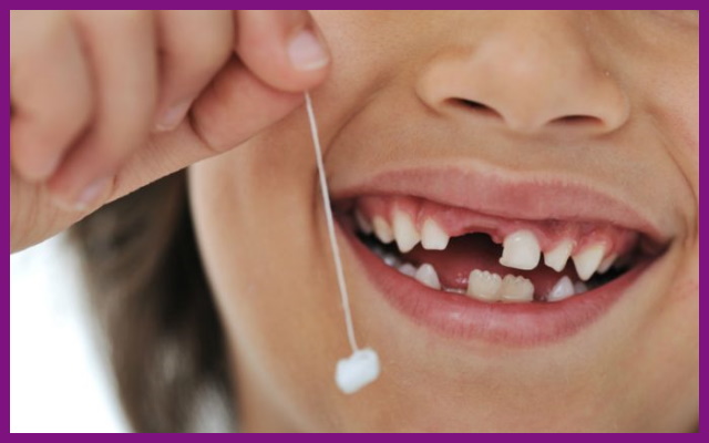 với răng sữa của trẻ, không nên tự nhổ răng tại nhà mà nên đến nha khoa nhờ bác sĩ giúp đỡ