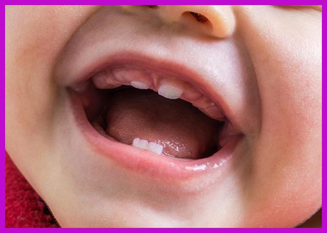 trẻ con mọc răng có ảnh hưởng gì không