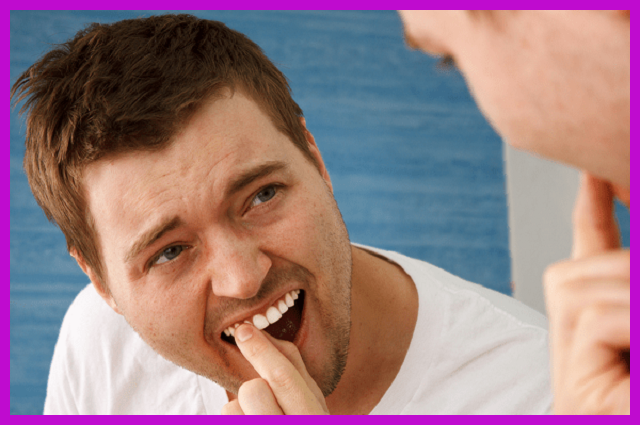 viêm nha chu cách điều trị giúp răng ổn