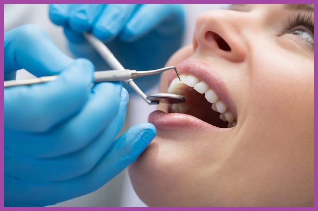 cách chữa viêm nha chu răng tại xo